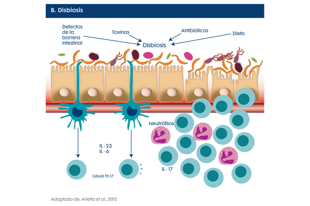 B. Disbiosis