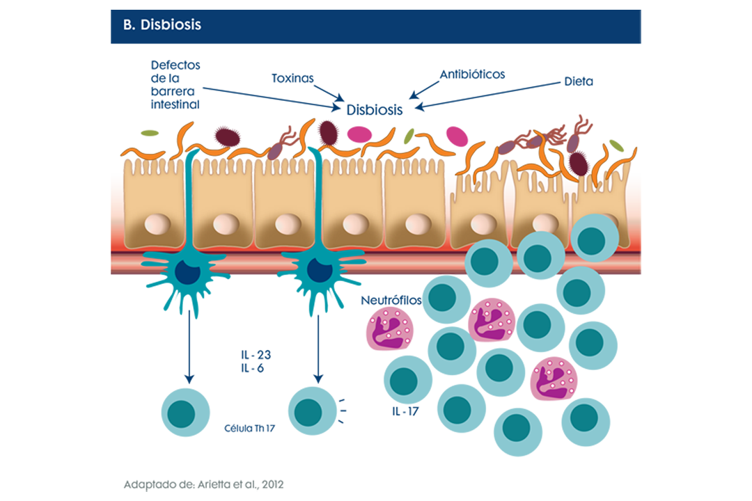 B. Disbiosis