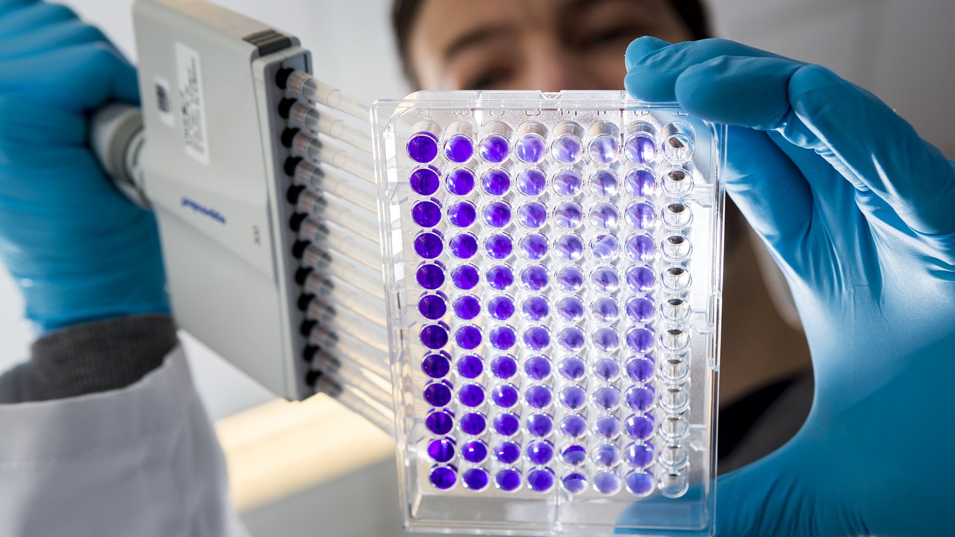 Investigación y Desarrollo